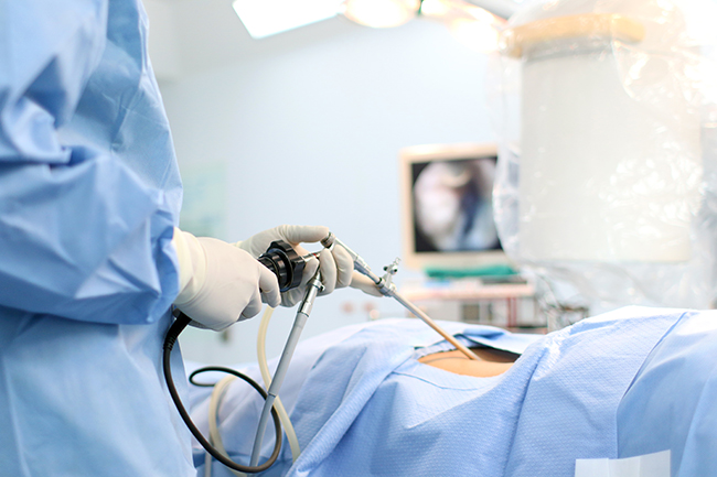 Cirujano plástico con laparoscopia de bypass gástrico.